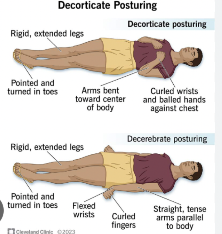 <p>GCS - motor response</p>