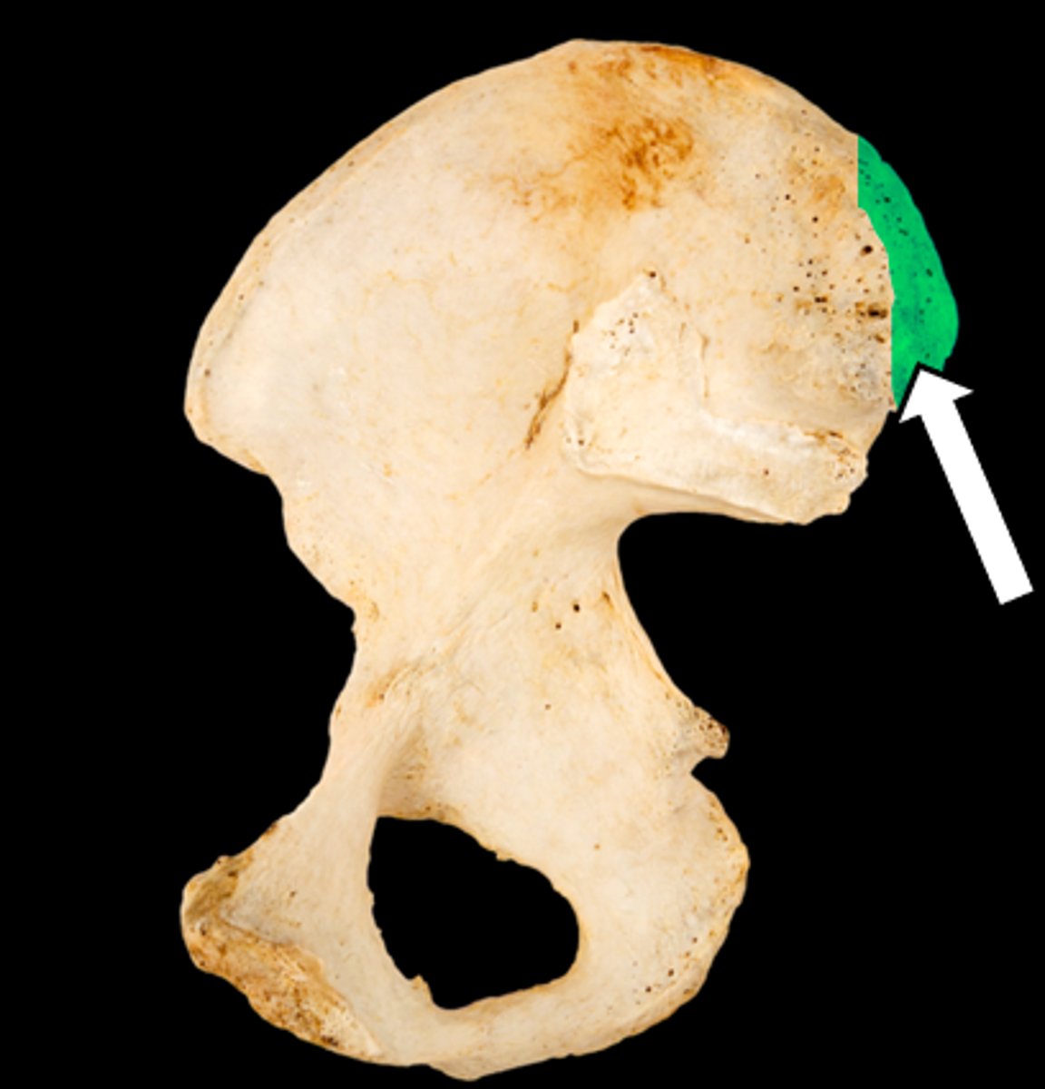<p>name the part</p>