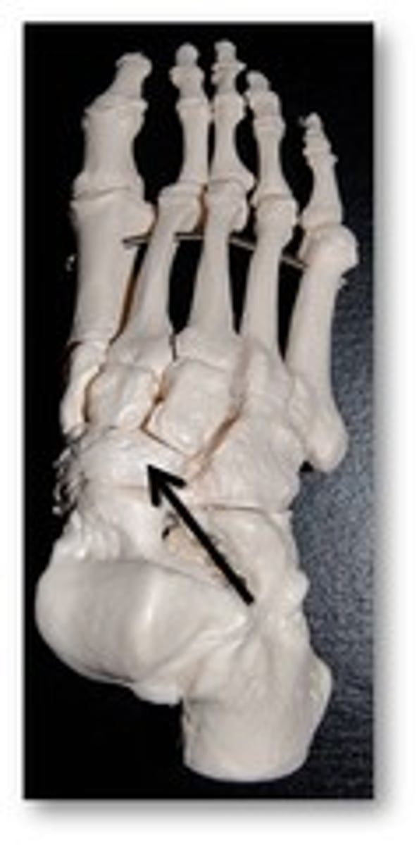 <p>ID specific bone</p>