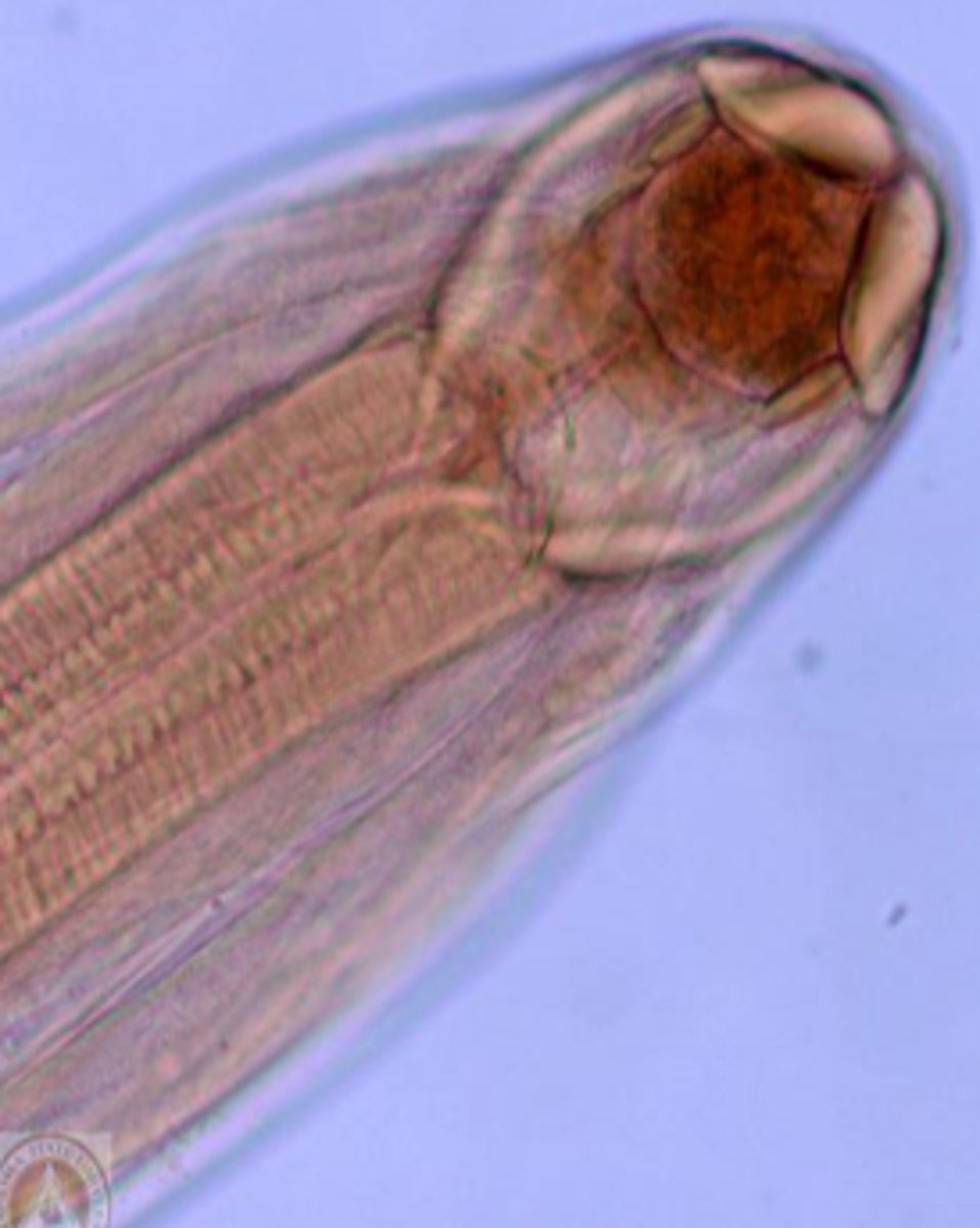 <p>Hookworms</p><p>No teeth, cutting plates</p>
