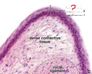 <p>what type of epithelium is the nose, pharynx, and esophagus (upper tract) composed of?</p>