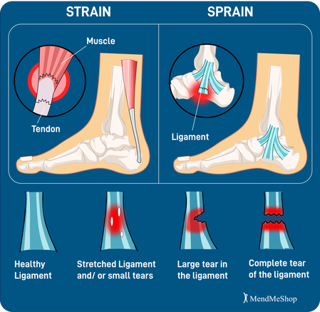 <p>strain</p>