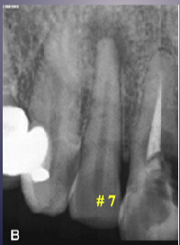 <p>what’s the pathology of #7 </p>