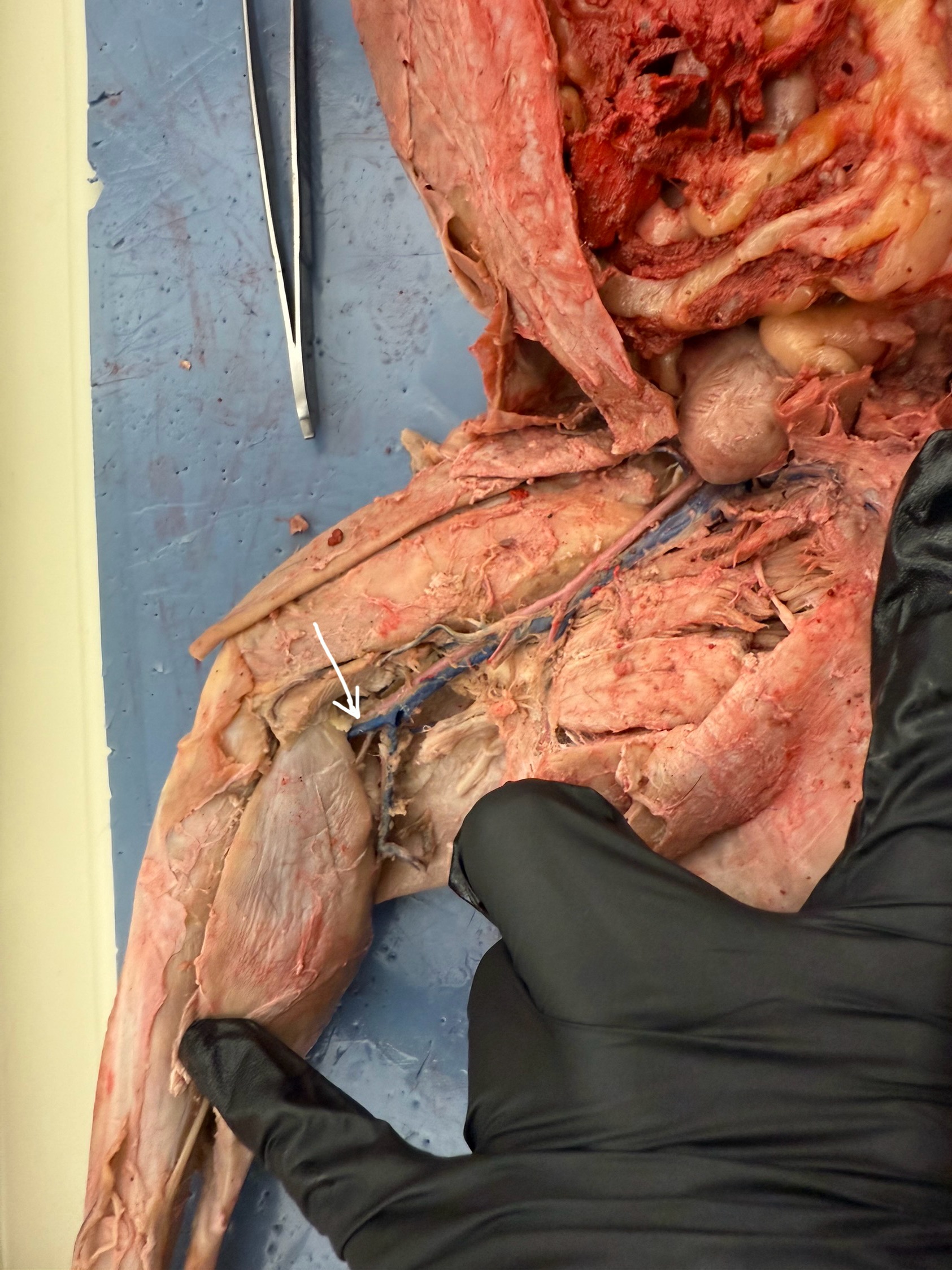 <p>What is the pointer at?</p>