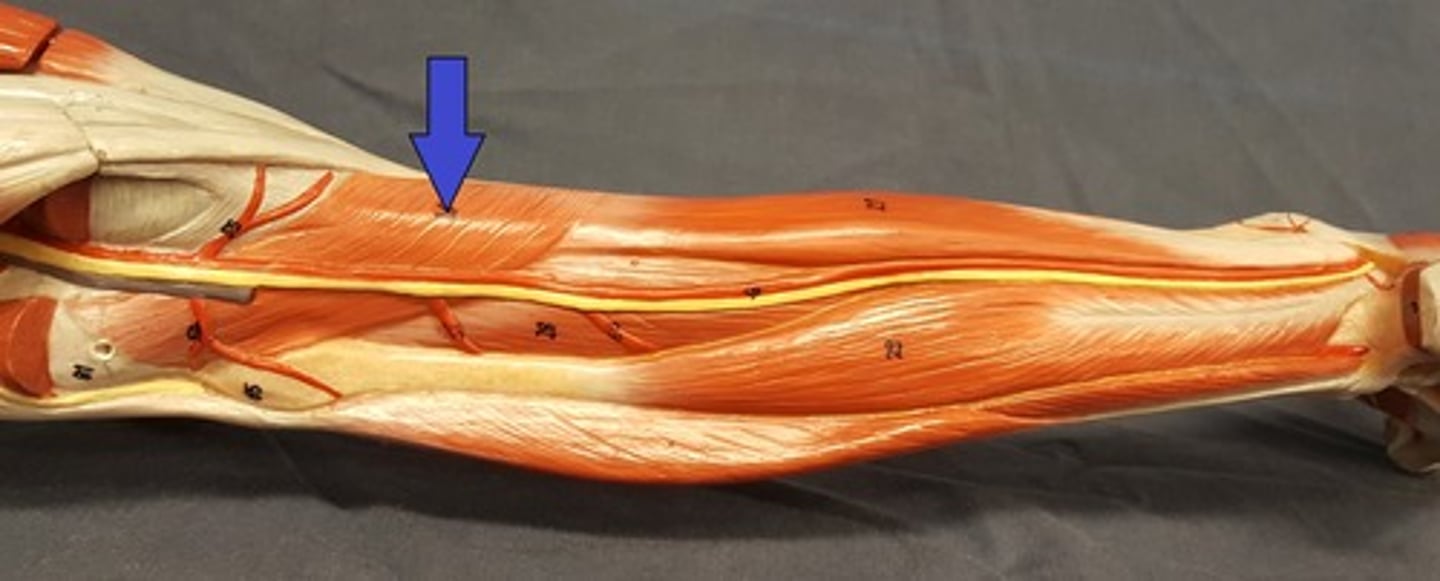 <p>Seen after removing the gastrocnemius m. runs at an angle superior to the flexor hallucis longus m. the posterior tibial m. and the flexor digitorum longus m.</p>