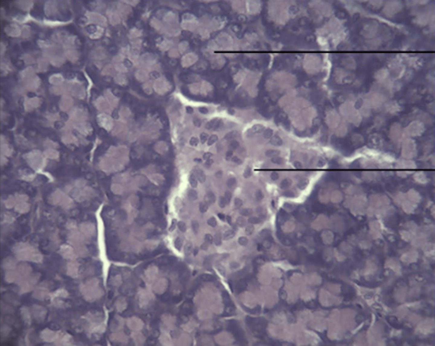 <p>gland</p>