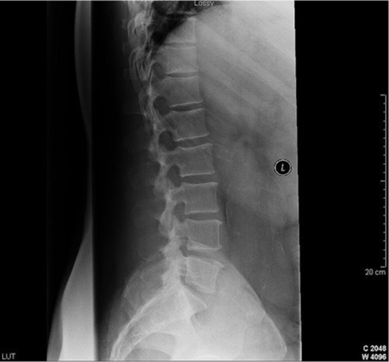 <p>what is wrong</p>