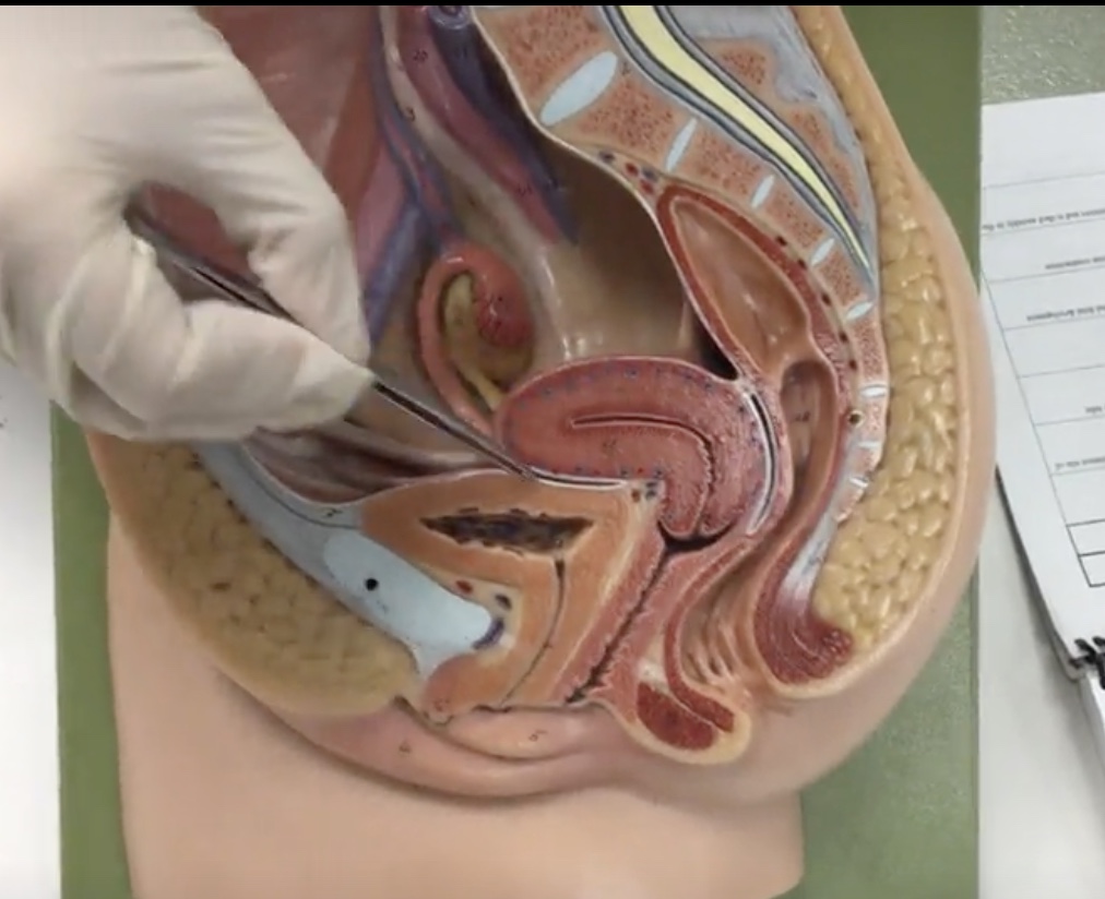 <p>Description: Pear shaped organ posterior to the urinary bladder</p><p>Relationship: Site of ovum implantation and fetal development</p>