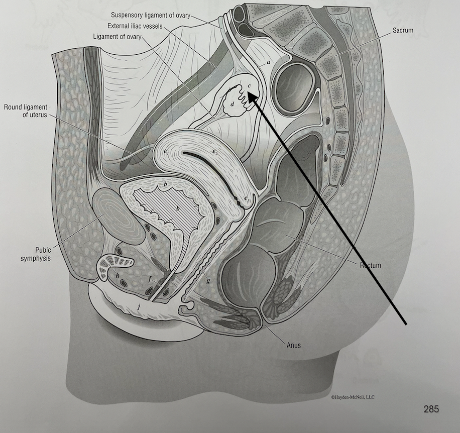 <p>what structure is this</p>