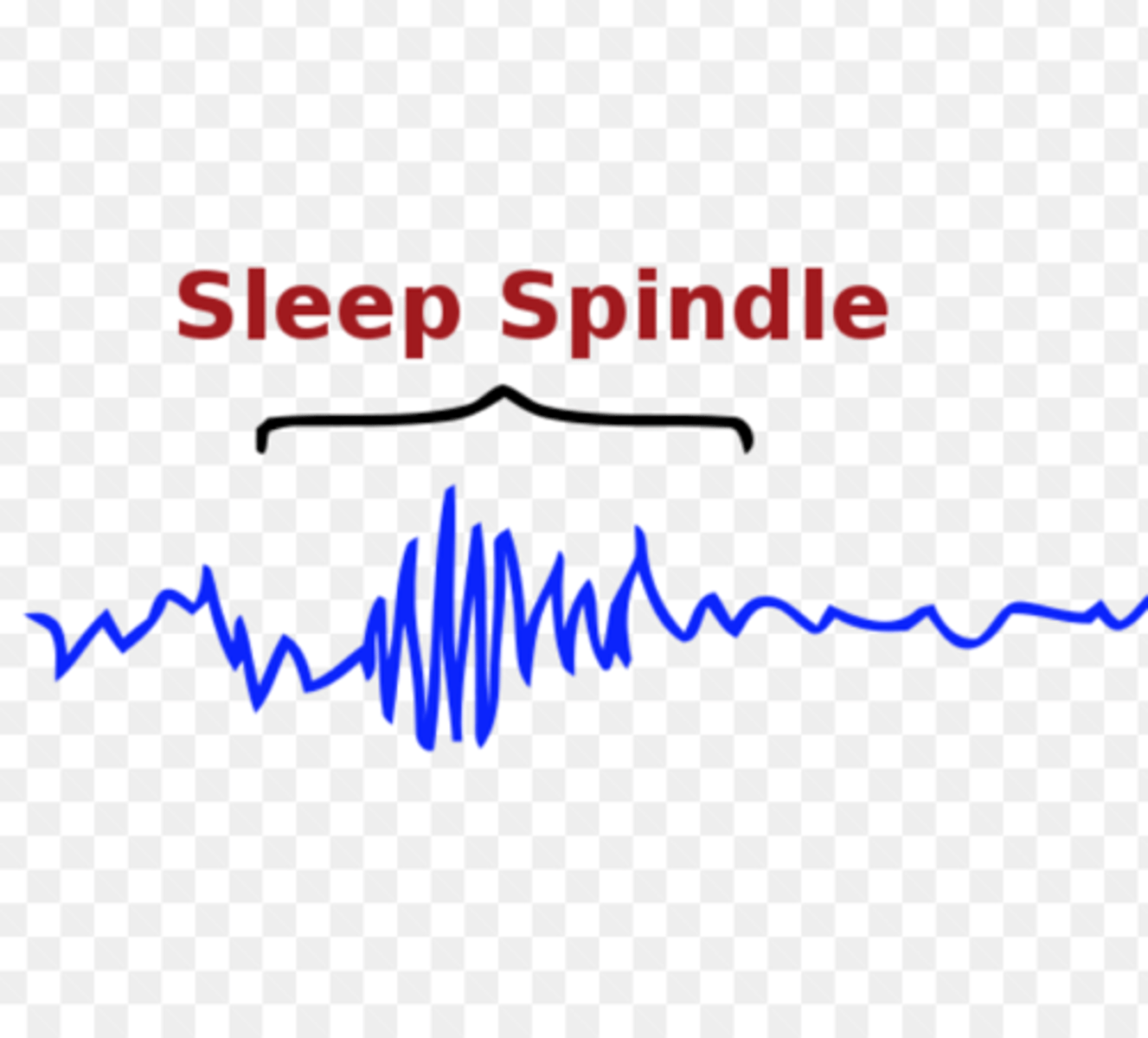 <p>(D) Sleep spindles</p><p>Sleep spindles refer to a burst of rapid brain activity during sleep, that some researchers believe help inhibit certain perceptions so that one can maintain a tranquil state during sleep</p>