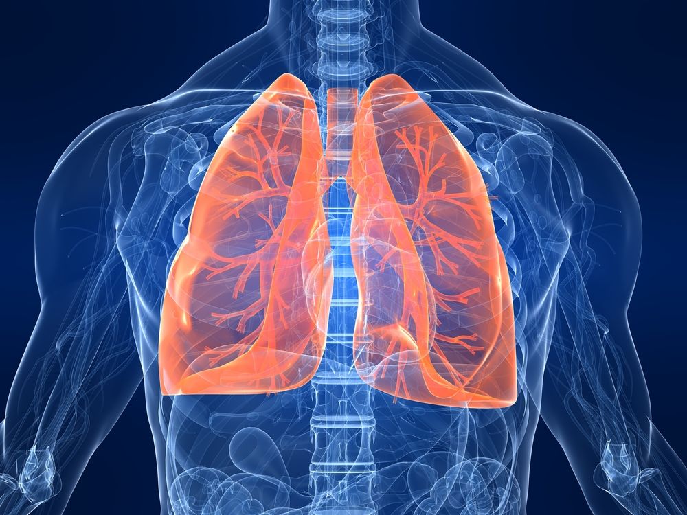 <p>lung<br>eg. pneumonia</p>