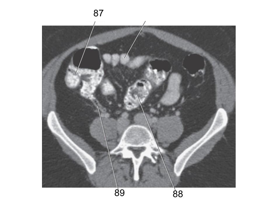 <p>88</p>