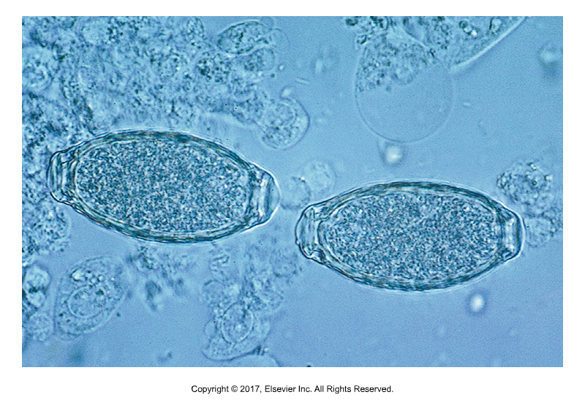 <p>Bladder worm</p><ul><li><p>Adults found in bladder ​</p></li><li><p>Larvae get into Earthworms​</p></li><li><p>Definitive host ingests worms​</p></li><li><p>Eggs can be confused with whipworms​</p></li><li><p>Bipolar flattened plugs</p></li></ul><p></p>
