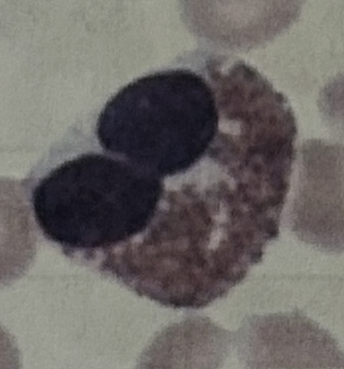 <p>WBC</p>
