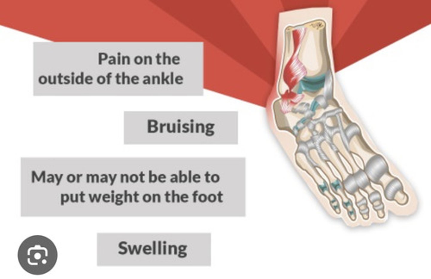 <p>- pain, inflammation</p><p>- contusion (bruise)</p><p>- decreased function</p>