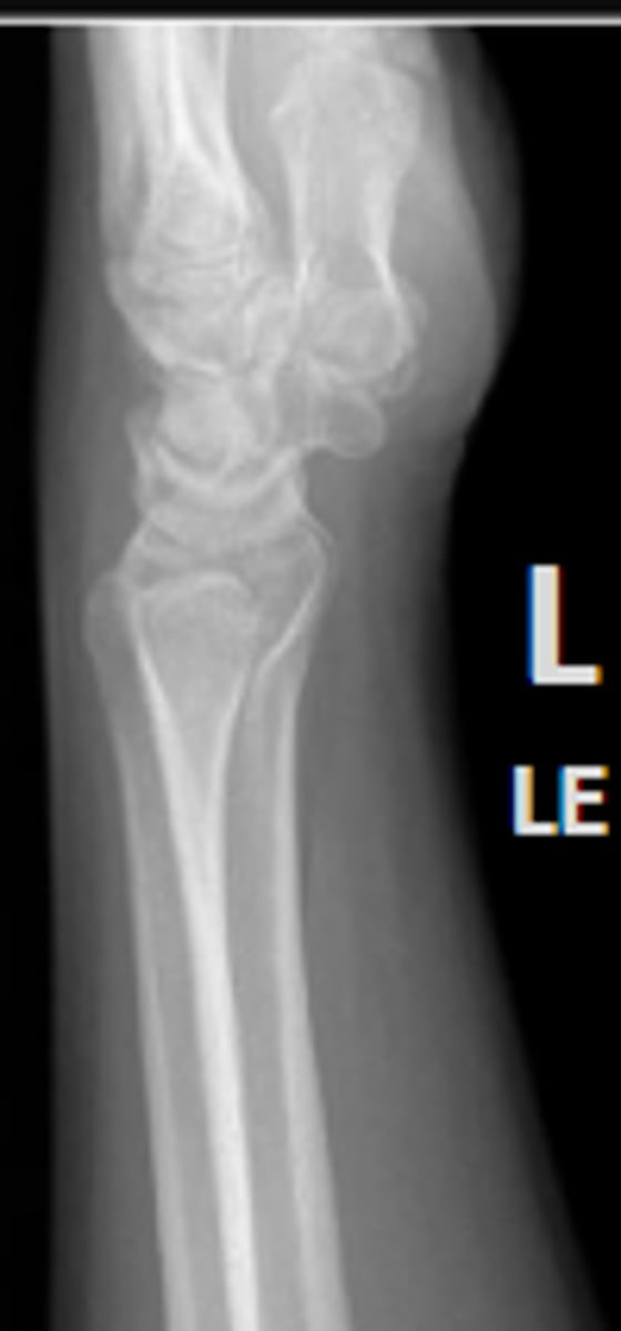 <p>What is the name of the radiographic view?</p>