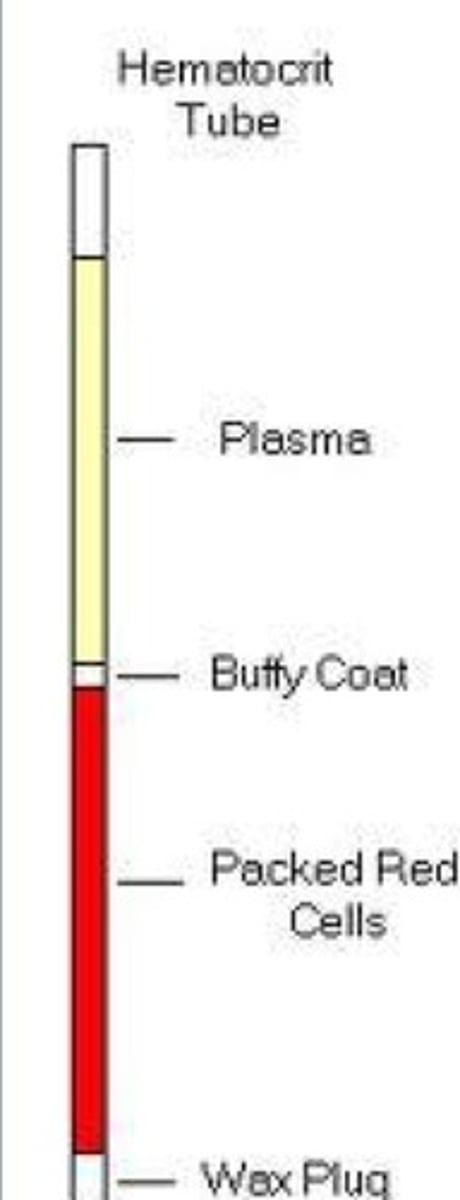 <p>separates blood sample into different components</p>