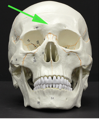 <p>What bone is marked by the green arrow?</p>