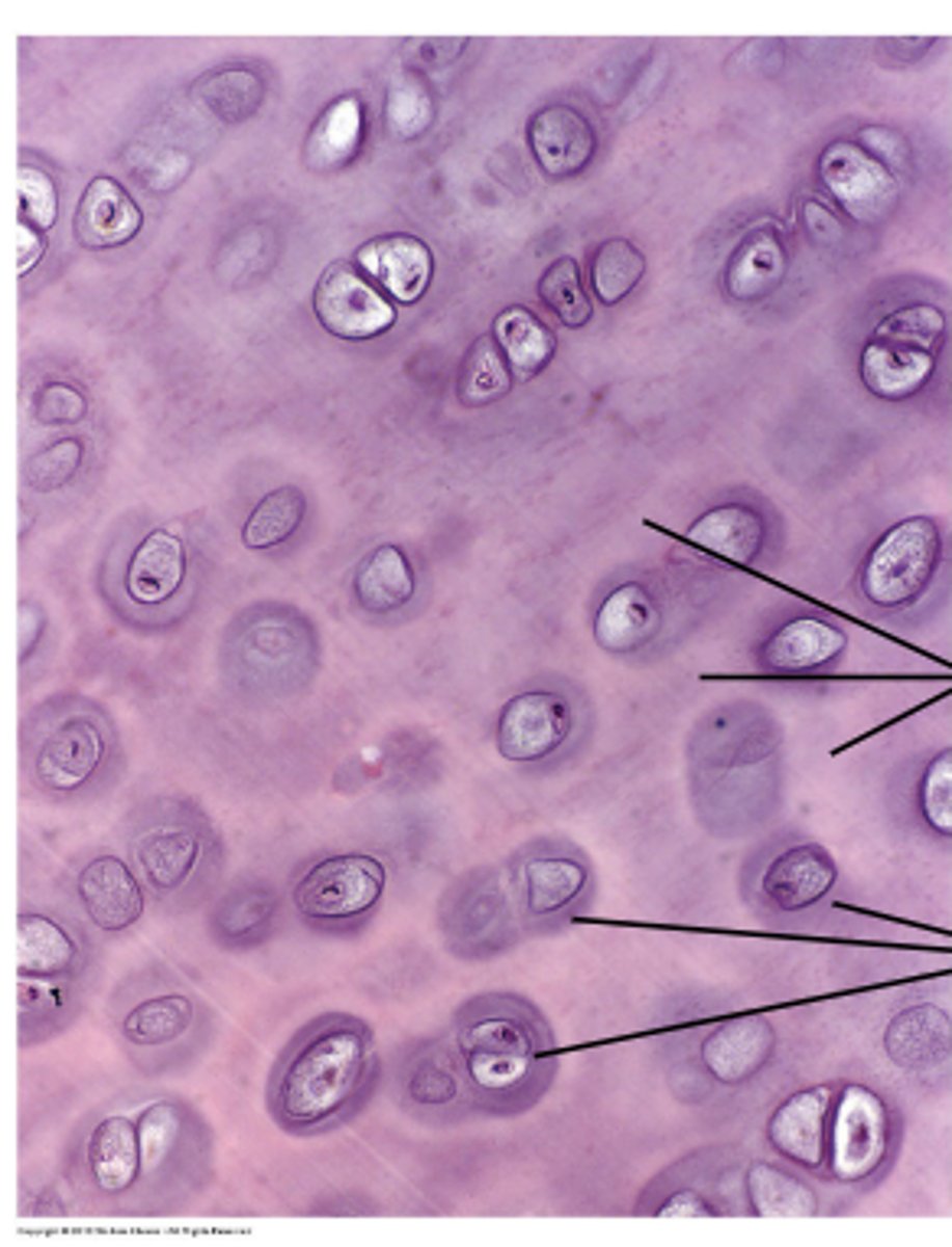 <p>Territorial matrix = hög halt proteoglykaner</p><p>Interterritorial matrix = hög halt kollagen</p>