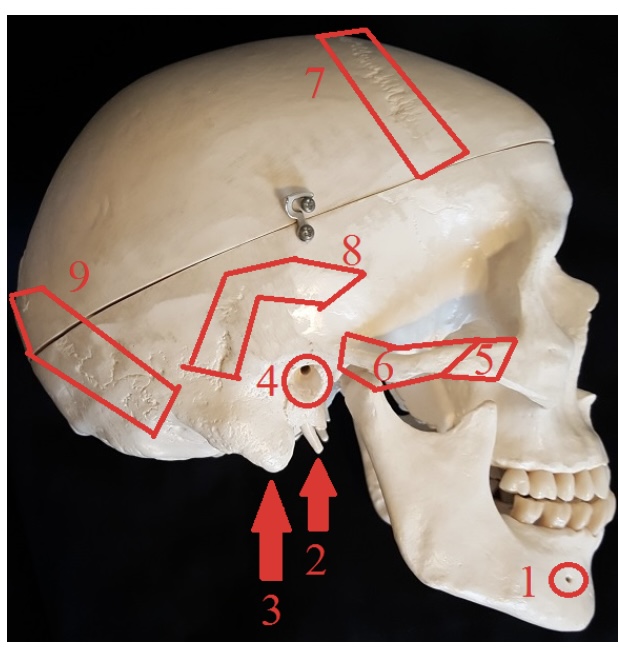 <p>7) name this line</p>