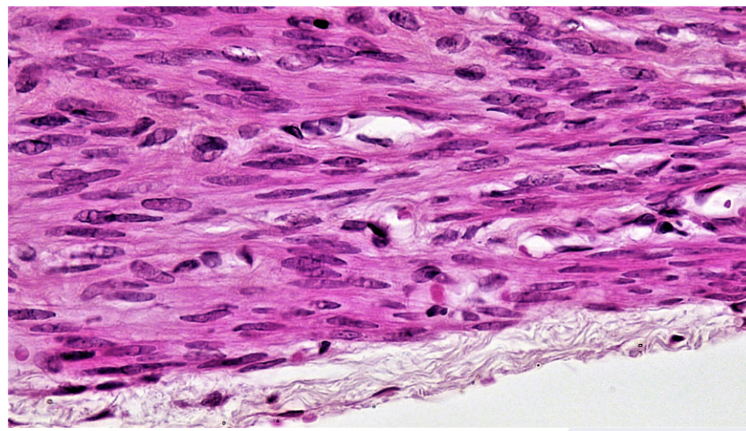 <p>Smooth Muscle</p><p>Non-striated, Single nucleus, and Involuntary&nbsp;</p><p>Found in: Many organs/structures like blood vessels, airways to lungs, stomach, intestines, gallbladder, etc.. </p>