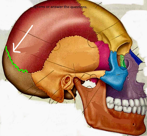 <p>What suture is this?</p>