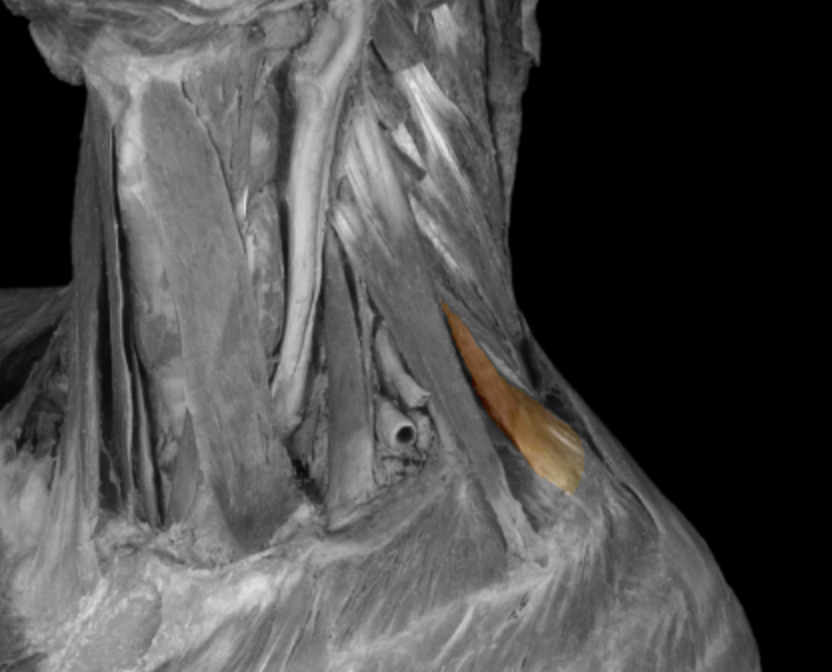 <p>What muscle is this? </p>