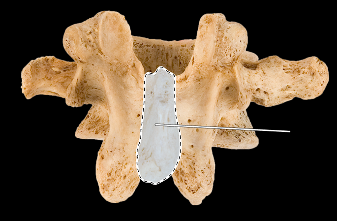 <p>What part of the vertebra is highlighted?</p><p>What type of vertebra is this (which region is this vertebra from)?</p><p>(Posterior view).</p>