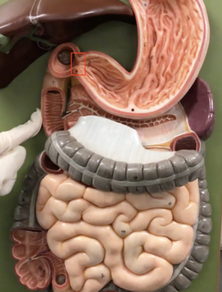 <p>name the muscle</p>