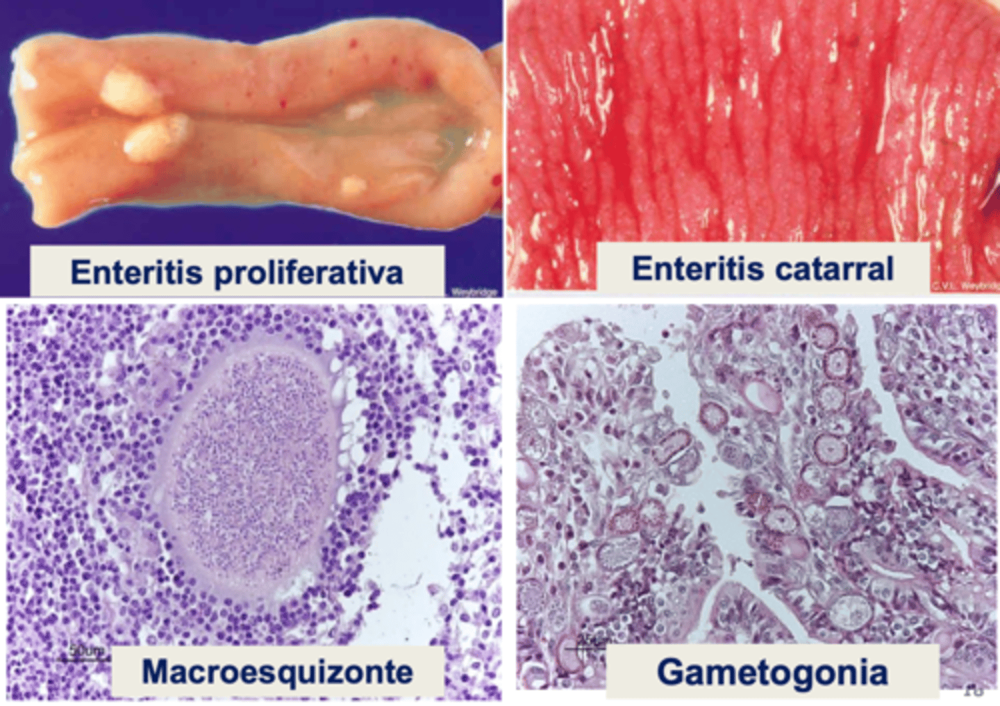 <p>enteritis catarral</p><p>- ID y IG</p><p>- engrosamiento, edema, congestión, petequias/hemorragias difusas</p><p>- placas/nódulos blanquecinos</p><p>- atrofia de vellosidades e hiperplasia de criptas</p><p>E. gilruthi → abomasitis proliferativa</p>