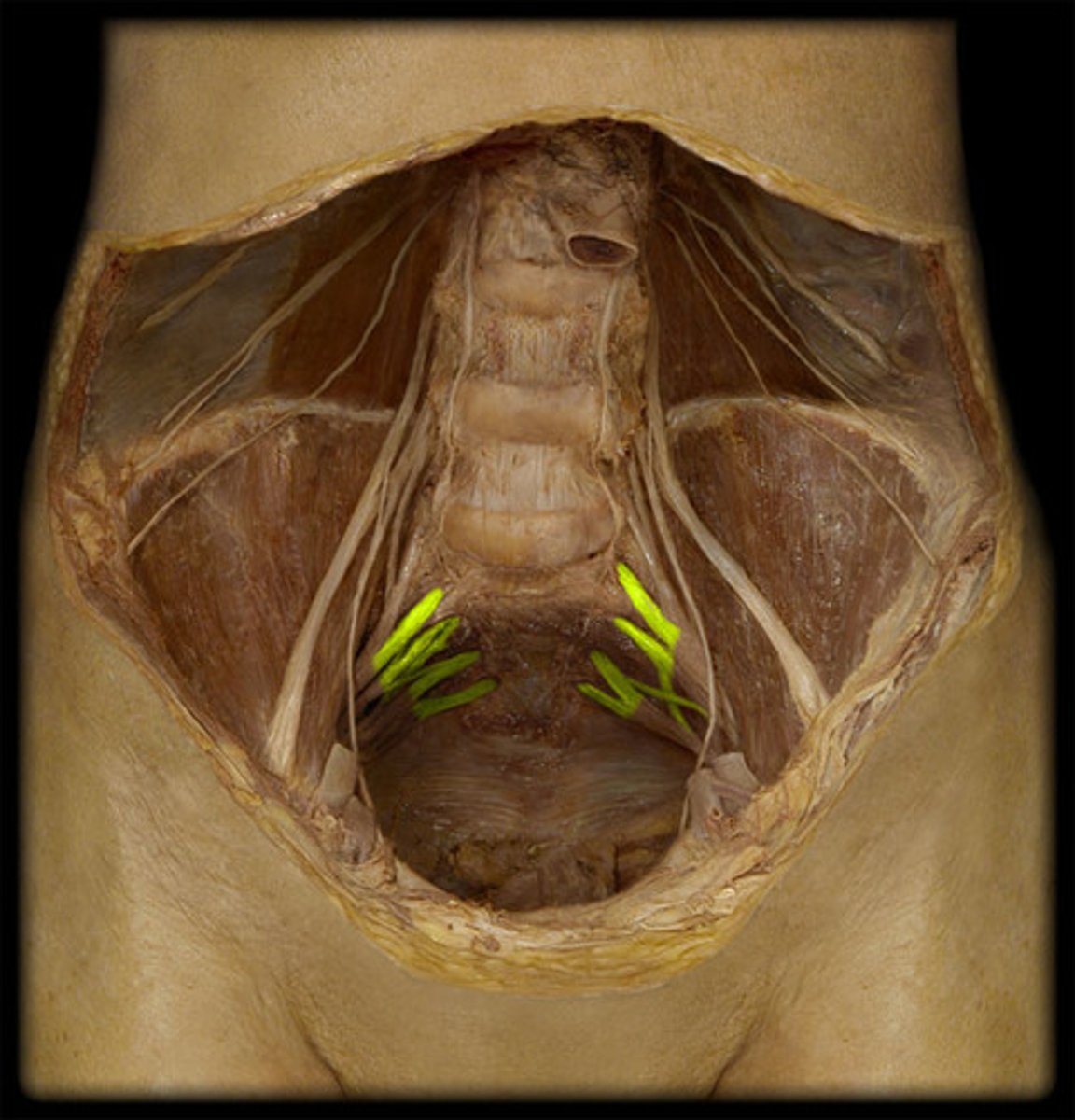 <p>anterior rami (L1-3)</p>