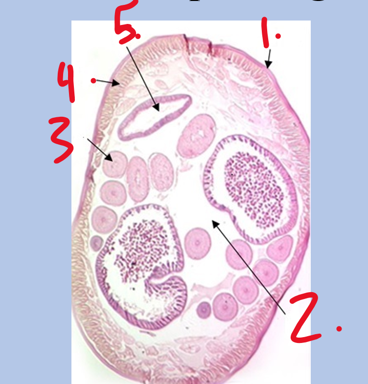 <p>Label each of these parts for this <em>Ascaris</em> Cross Section.</p><p>Word Bank:</p><p>Longitudinal Muscle</p><p>Pseudocoel</p><p>Intestine</p><p>Cuticle</p><p>Reproductive Organ</p>