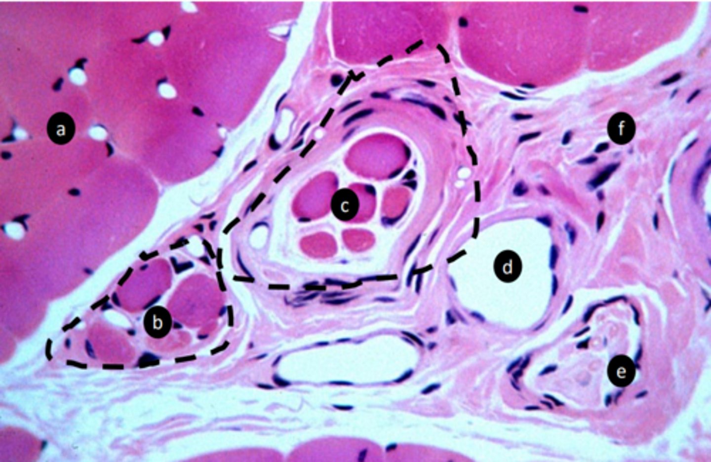 <p>g: tissue type</p>