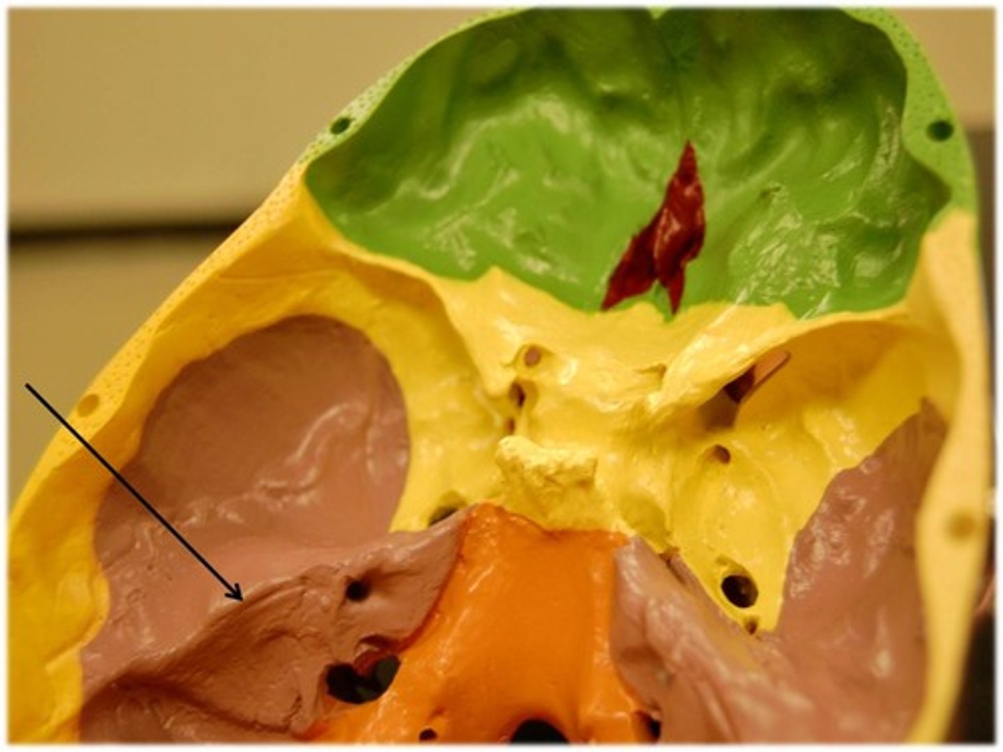 <p>(Temporal)</p><p>Forms a bony wedge between the sphenoid and occipital bones and contributes to the cranial base</p>