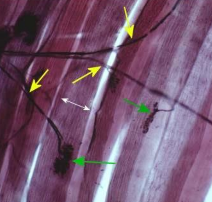 <p>What is the WHITE arrow pointing to?</p>