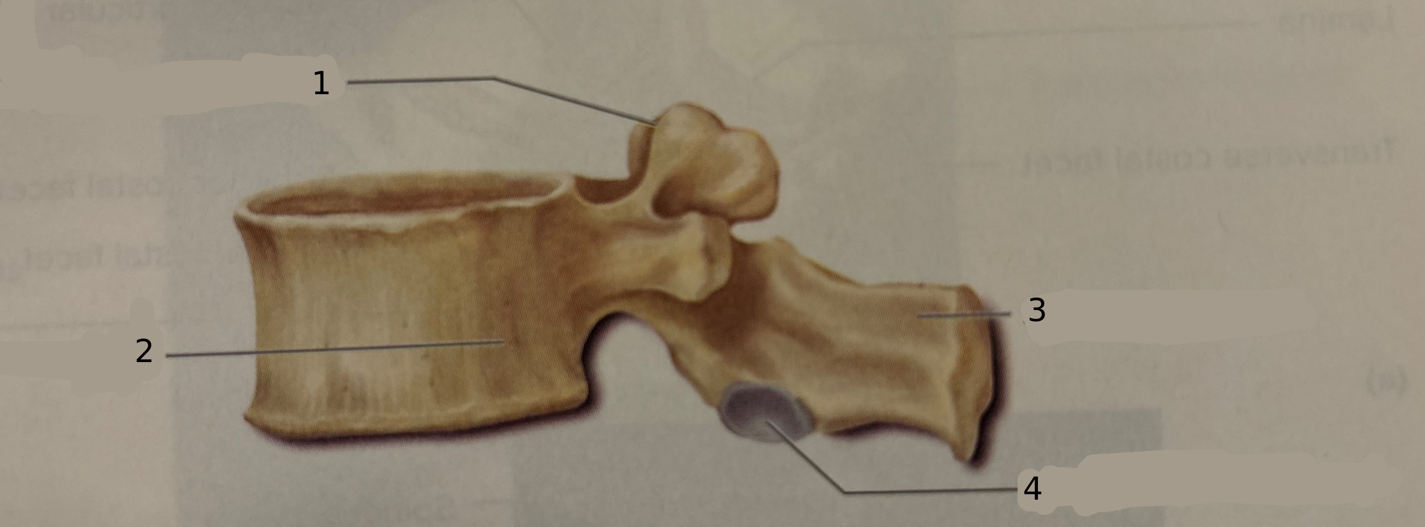 <p>What type of vertebra is this?</p>