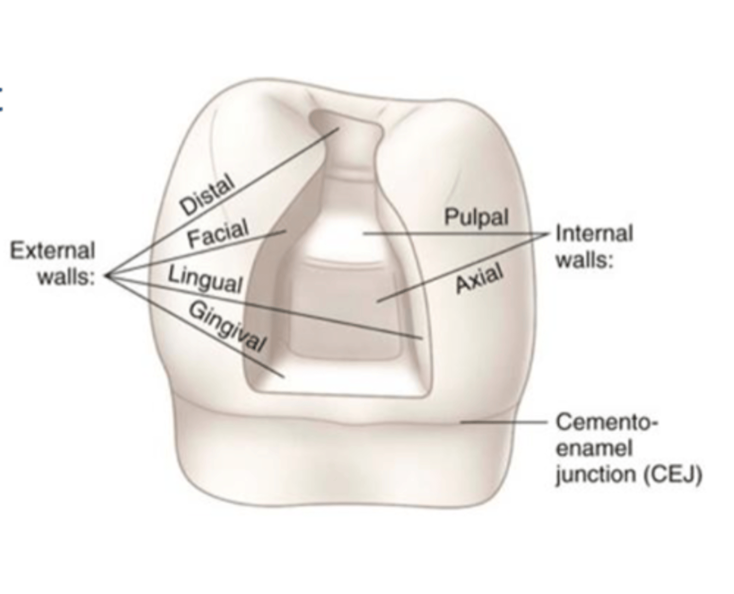 <p>perpendicular to long axis of tooth closest to the pulp in the horizontal plane</p>