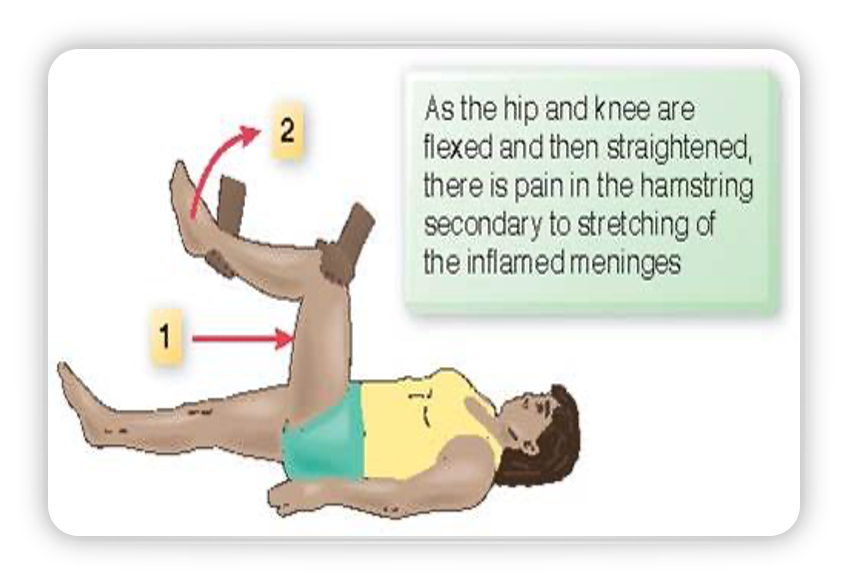 <p><span>as the hip and knees are flexed and then straightened, there is pain in the hamstring secondary to stretching of the inflamed meninges</span></p><p></p>