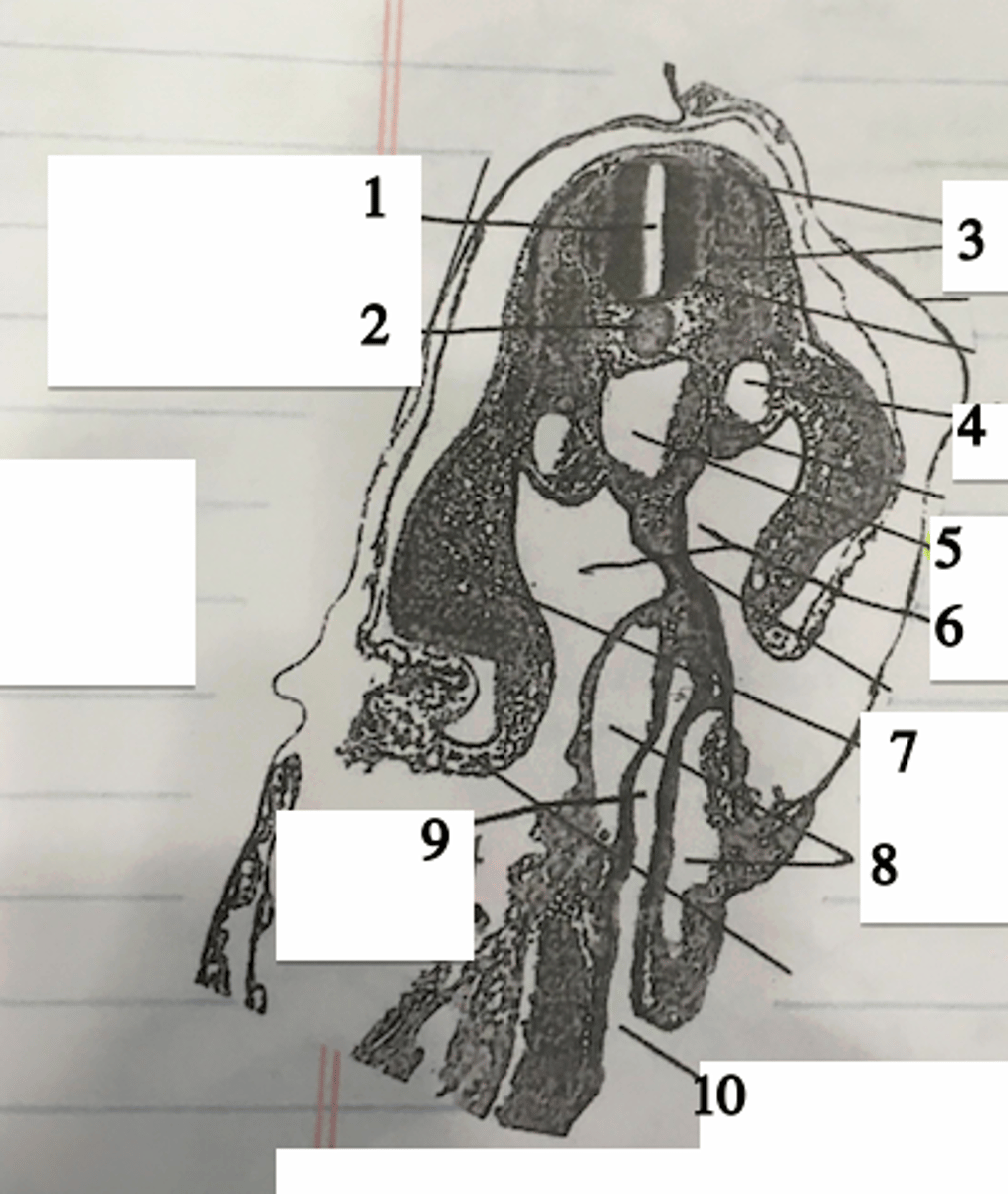 <p>Not that the forgut (9) is _________ at the cranial intestinal portal (10) which will close</p>