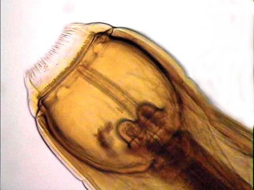 <p>Identify the Strongylus sp. depicted in this image.</p>