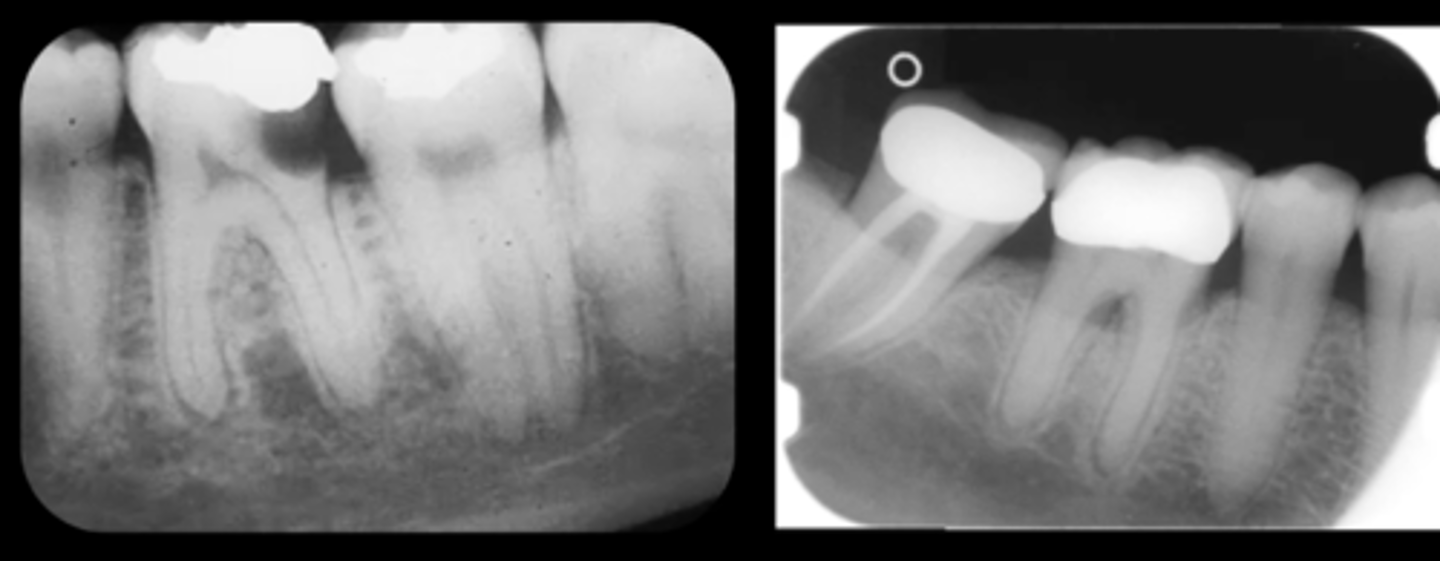 <p>• Apical infection/inflammation</p><p>• Peridontal status</p><p>• Trauma to the teeth and alveolar bone</p><p>• Assessment of unerupted teeth</p><p>• Assessment of roof morphology</p><p>• Pre treatment</p><p>• During endodontics</p><p>• Post treatment</p><p>• Detail on apical cysts and lesions</p>