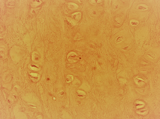<p>A type of cartilage that contains dense bundles of collagen fibers, providing strong support and the ability to withstand pressure. It is found in areas such as intervertebral discs and the pubic symphysis. </p>