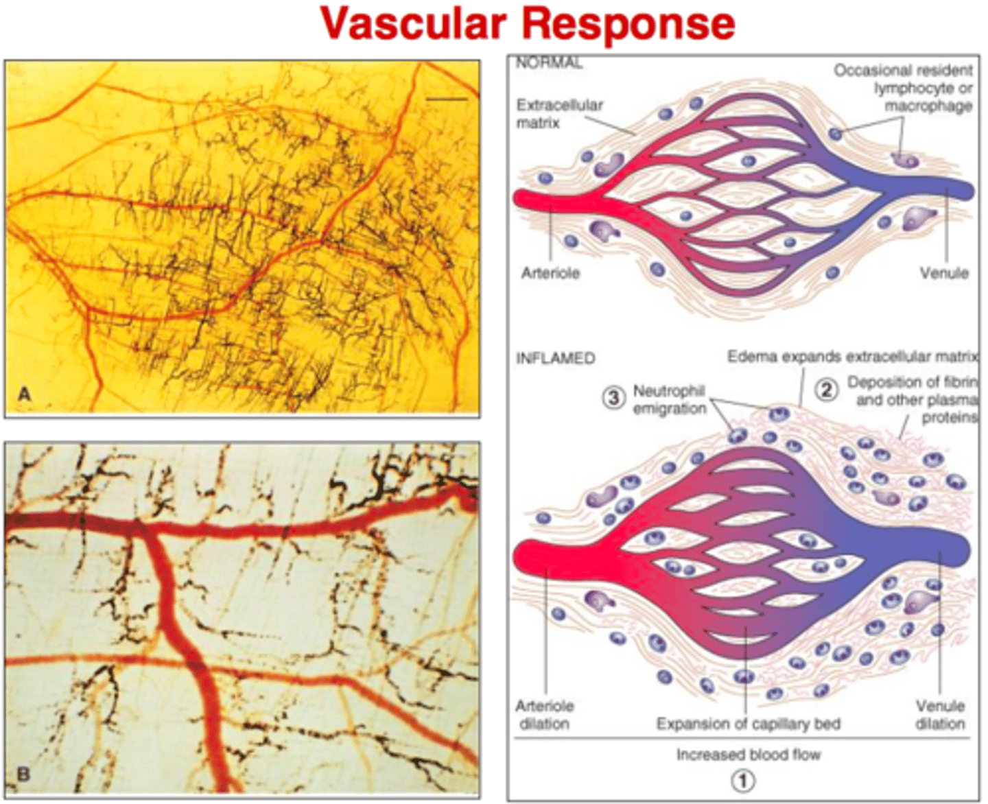 <p>Overall vasodilation and increased capillary permeability</p>