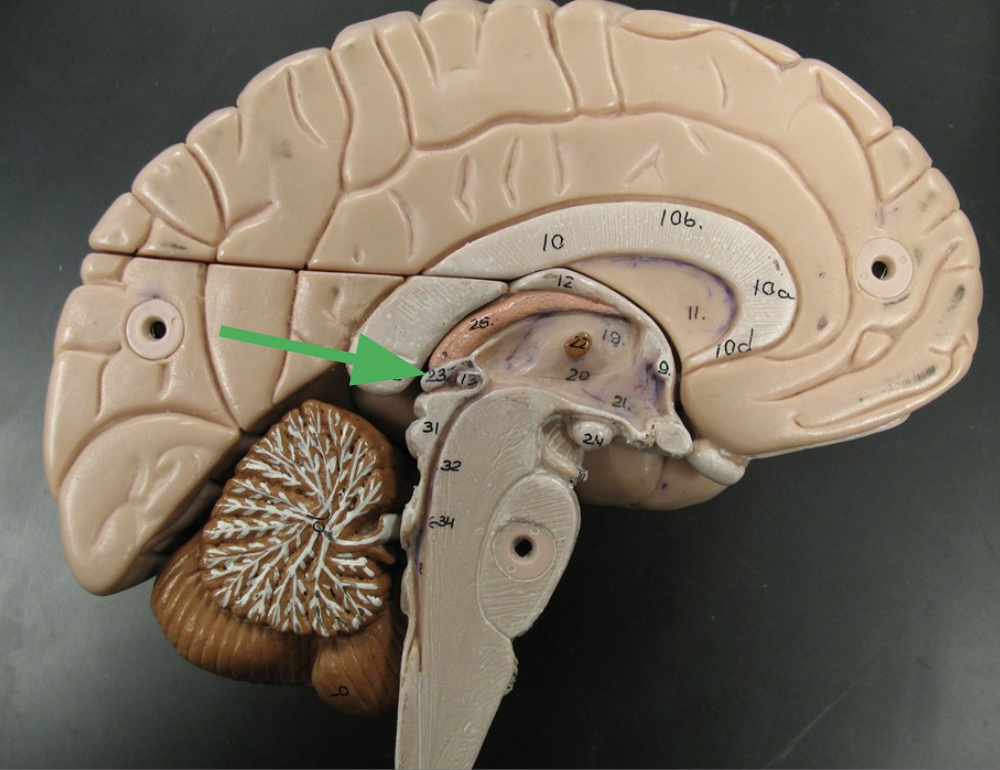 term image