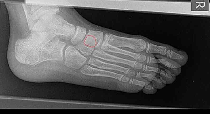 <p>What is this bone?</p>