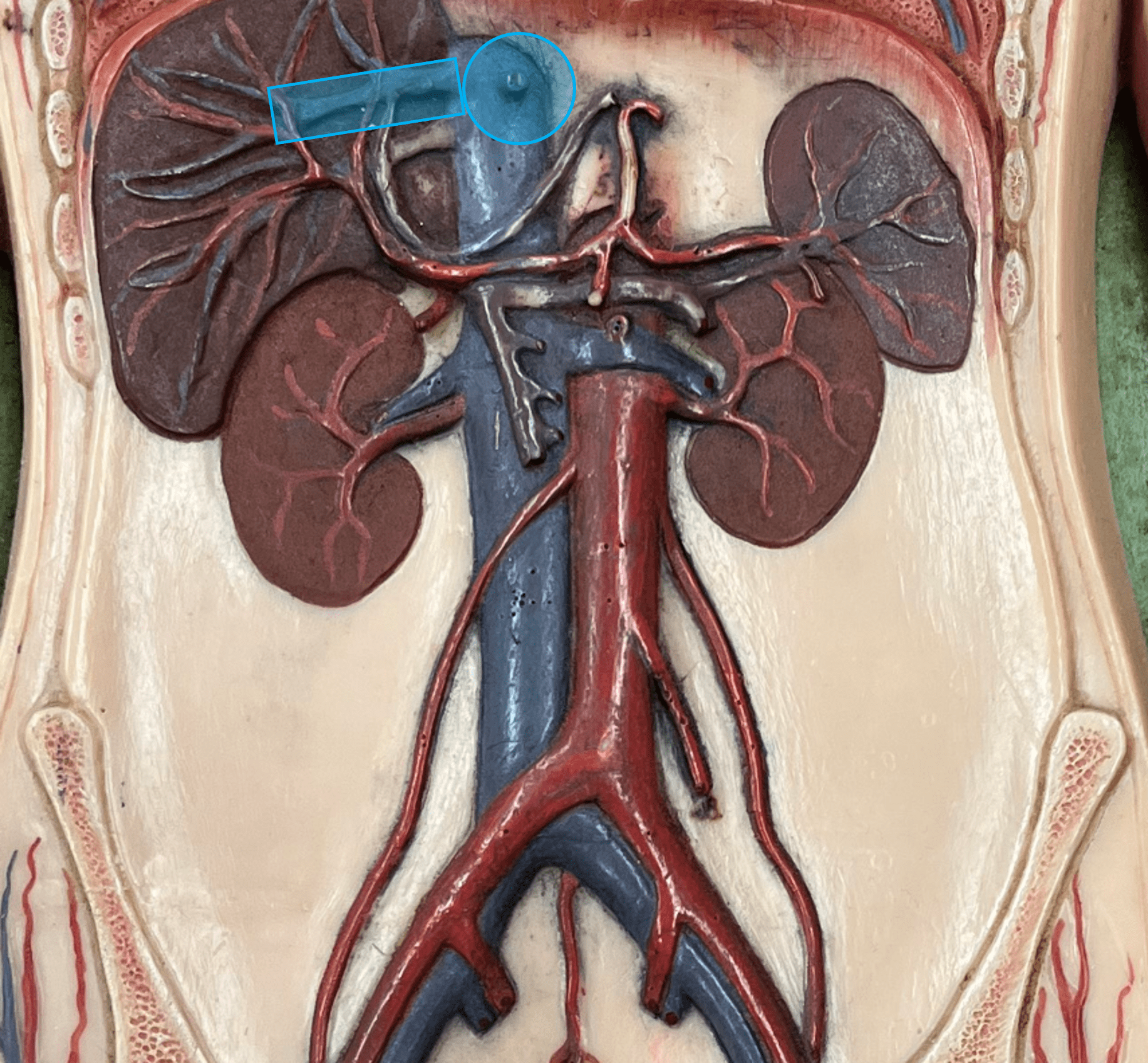 <p>• A vein of the abdomen.</p>
<p>• Drains the liver.</p>
<p>• Empties into the inferior vena cava.</p>
<p>• On the inferior vena cava, the most superior veins.</p>