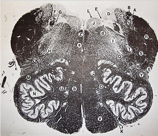 <p>G</p>