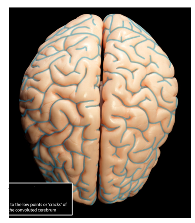 <p>what SLICES the gyri</p>