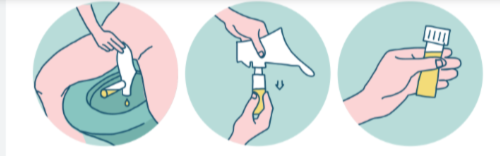 <p>Clean-Catch Urine Collection Kit</p>
