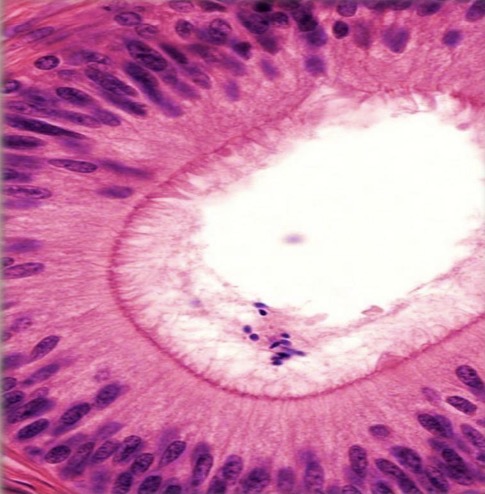 <p>Células epiteliales cilíndricas con microvellosidades largas</p>